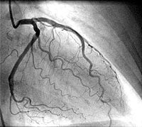 veins inside the heart